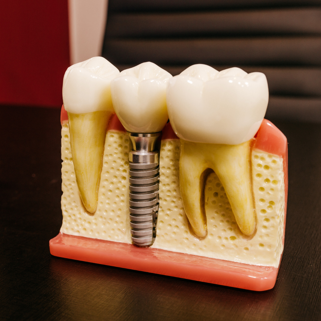 kansas-city-tooth-display-emergency-tooth-replacement